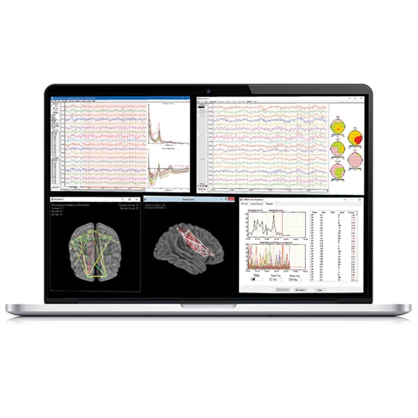 نرم افزار نوروگاید(neuroguide)چیست؟نرم افزار نقشه مغزی - پرتو دانش