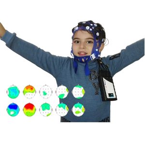 نقشه برداری مغز (QEEG) چیست؟