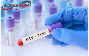 نمونه تست HIV